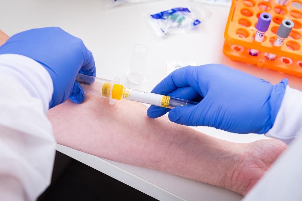 Tubos de coleta de sangue são identificados e ordenados por cores