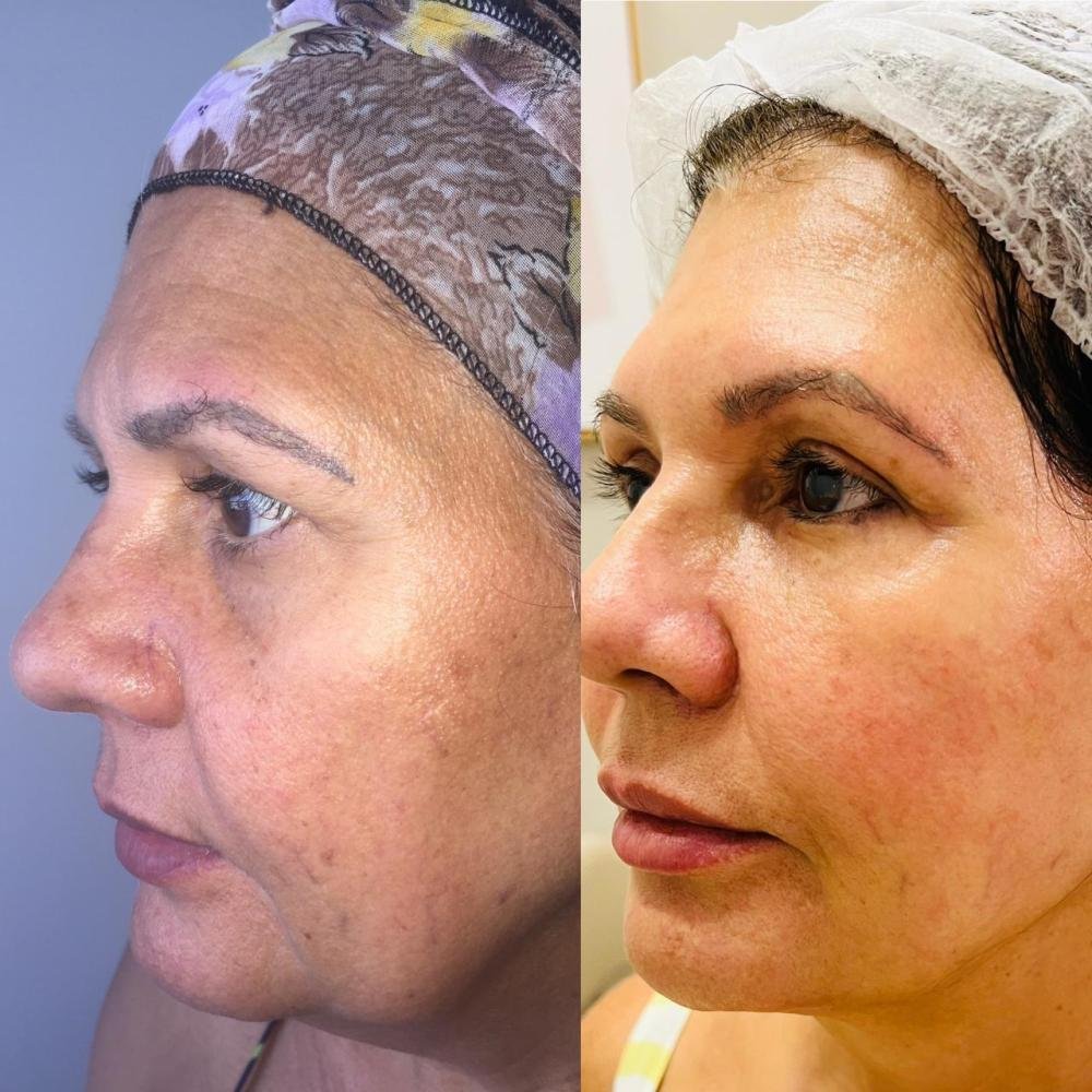 Identidade e beleza: O tratamento personalizado que está transformando vidas