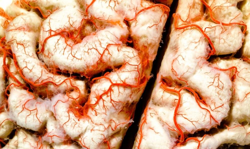 Número de casos de demência deve aumentar nas próximas décadas